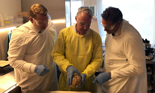 Australia Brain Bank