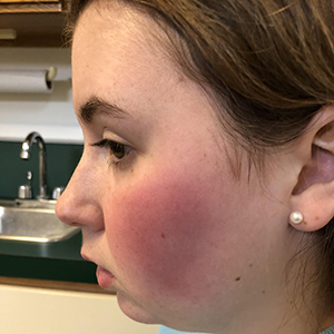 Erin Payne Concussion Legacy Foundation