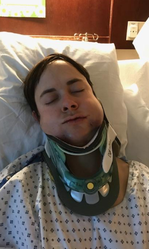 Jenn Miller Concussion
