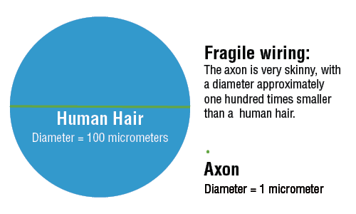 CTE Axon